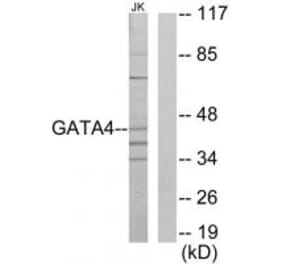 Western blot - GATA4 Antibody from Signalway Antibody (33773) - Antibodies.com