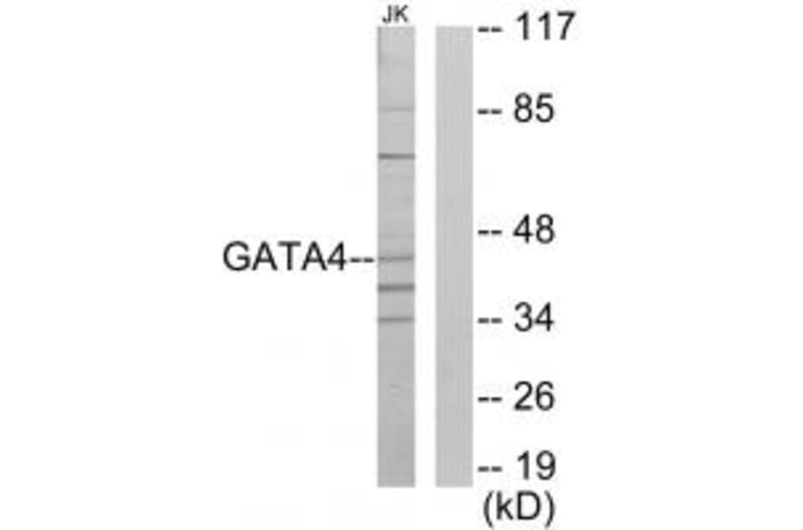 Western blot - GATA4 Antibody from Signalway Antibody (33773) - Antibodies.com
