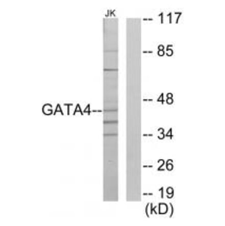 Western blot - GATA4 Antibody from Signalway Antibody (33773) - Antibodies.com