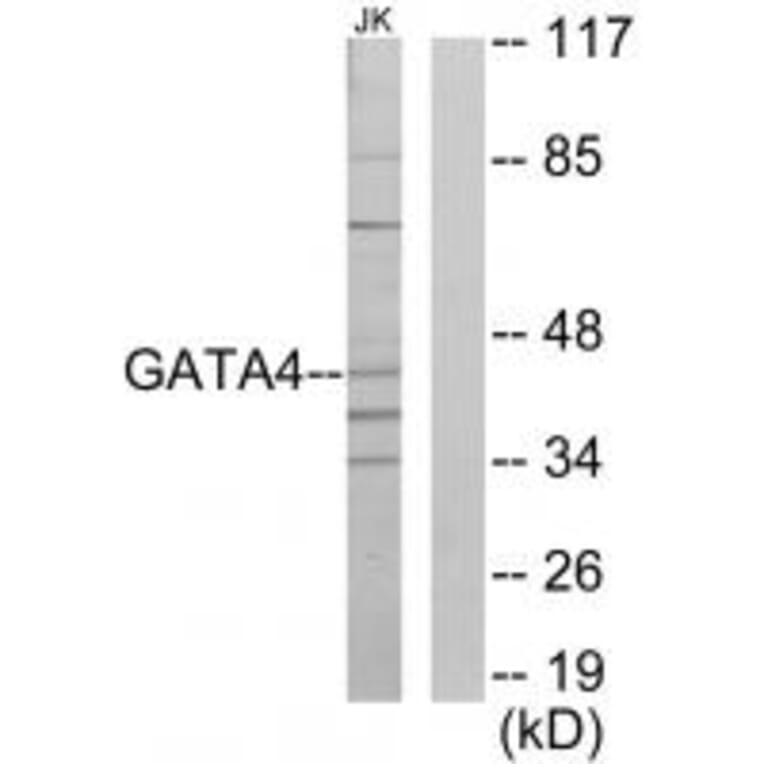 Western blot - GATA4 Antibody from Signalway Antibody (33773) - Antibodies.com