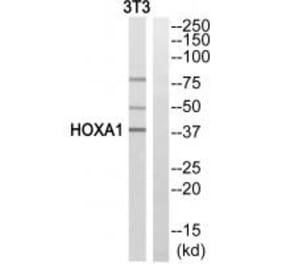 Western blot - HOXA1 Antibody from Signalway Antibody (33781) - Antibodies.com