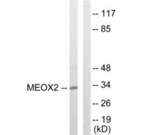 Western blot - MEOX2 Antibody from Signalway Antibody (33789) - Antibodies.com