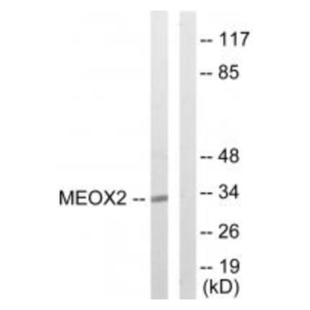 Western blot - MEOX2 Antibody from Signalway Antibody (33789) - Antibodies.com