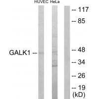 Western blot analysis of extracts from HUVEC cells and HeLa cells, using GALK1 antibody #33795.
