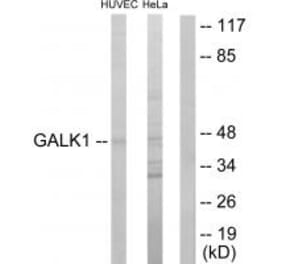 Western blot - GALK1 Antibody from Signalway Antibody (33795) - Antibodies.com