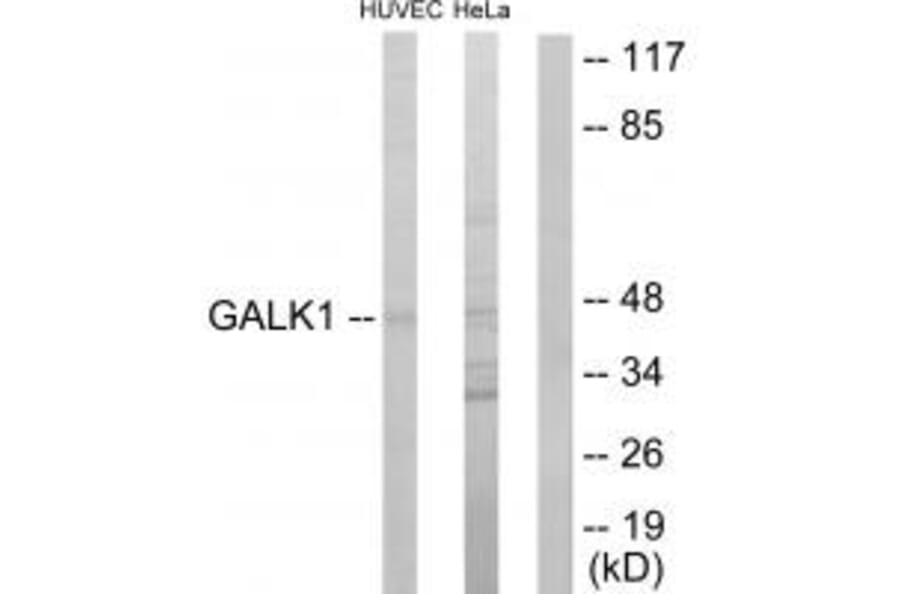 Western blot - GALK1 Antibody from Signalway Antibody (33795) - Antibodies.com