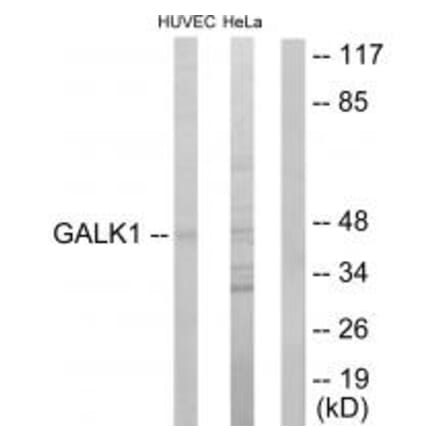 Western blot - GALK1 Antibody from Signalway Antibody (33795) - Antibodies.com