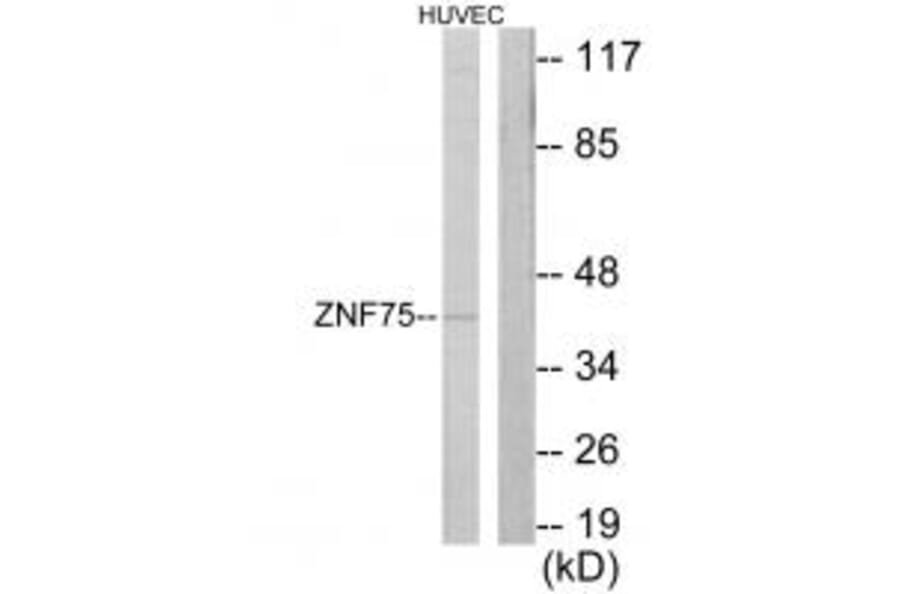 Western blot - ZNF75 Antibody from Signalway Antibody (33799) - Antibodies.com
