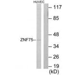 Western blot - ZNF75 Antibody from Signalway Antibody (33799) - Antibodies.com