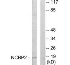 Western blot - NCBP2 Antibody from Signalway Antibody (33802) - Antibodies.com