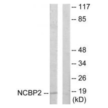 Western blot - NCBP2 Antibody from Signalway Antibody (33802) - Antibodies.com