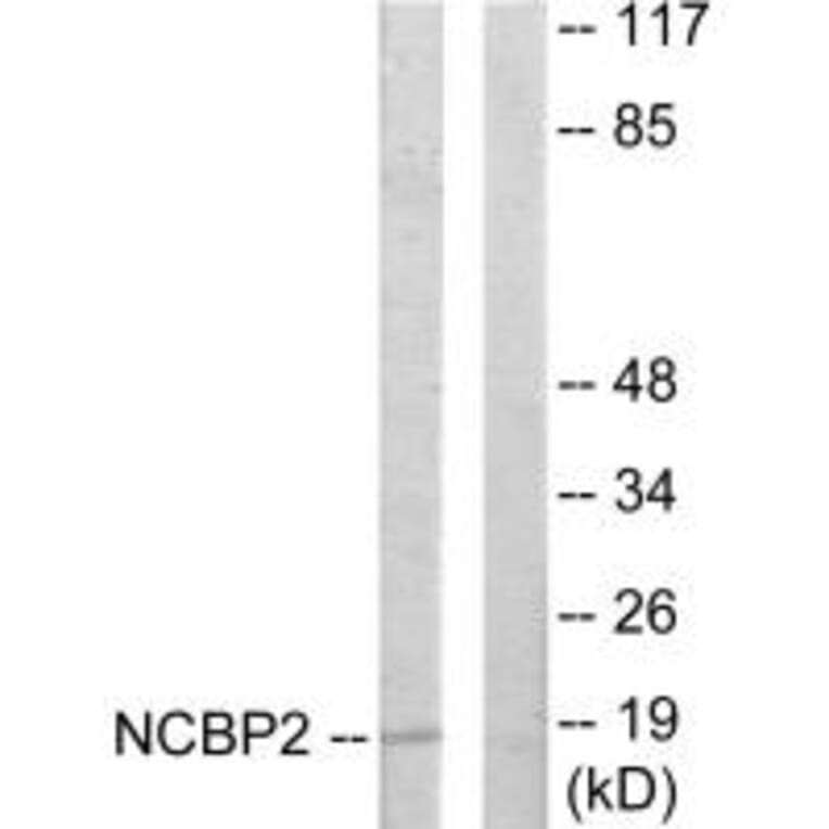 Western blot - NCBP2 Antibody from Signalway Antibody (33802) - Antibodies.com