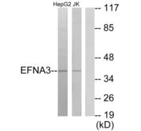 Western blot - EFNA3 Antibody from Signalway Antibody (33810) - Antibodies.com