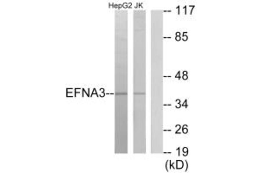 Western blot - EFNA3 Antibody from Signalway Antibody (33810) - Antibodies.com