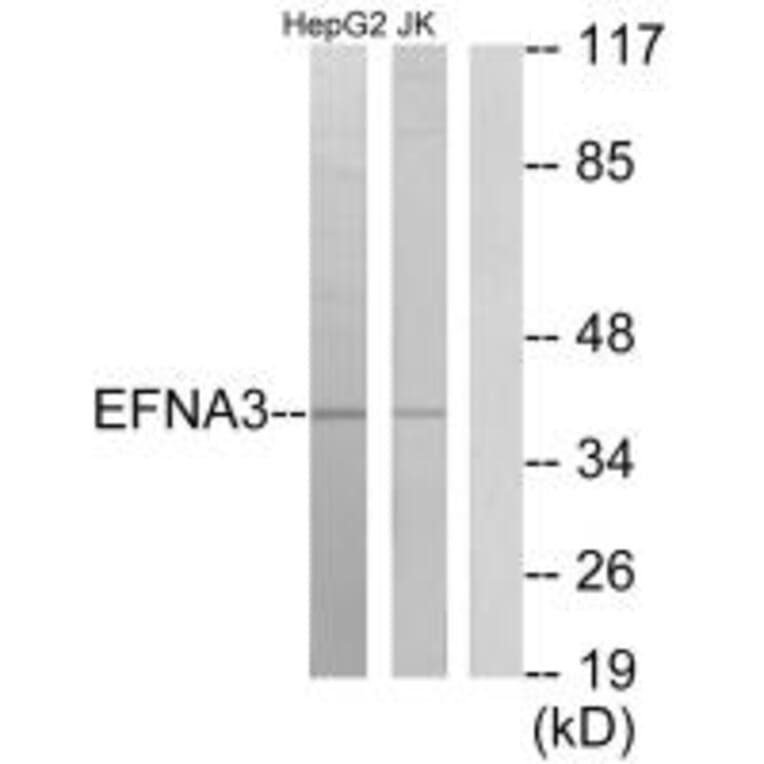 Western blot - EFNA3 Antibody from Signalway Antibody (33810) - Antibodies.com