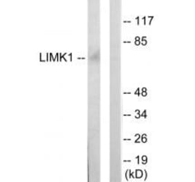 Western blot - LIMK1 Antibody from Signalway Antibody (33814) - Antibodies.com