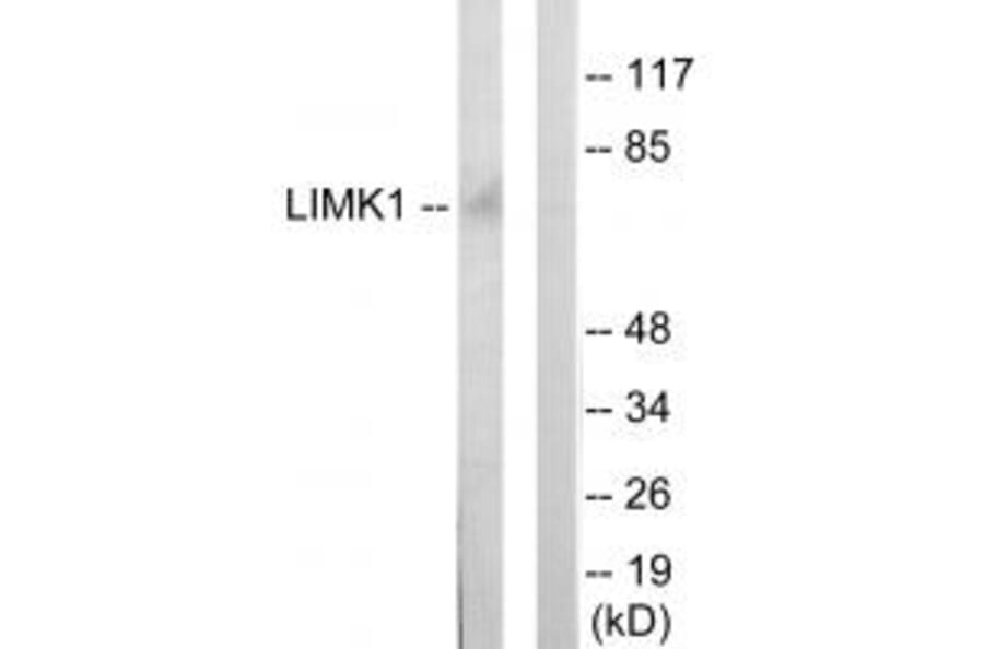 Western blot - LIMK1 Antibody from Signalway Antibody (33814) - Antibodies.com