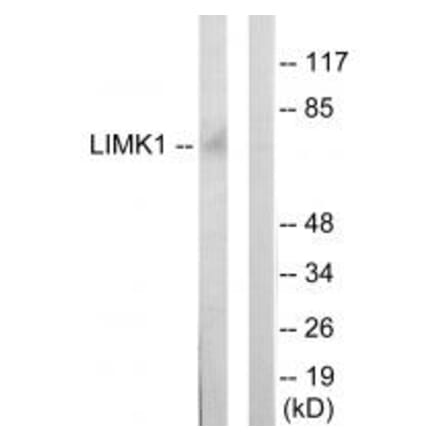 Western blot - LIMK1 Antibody from Signalway Antibody (33814) - Antibodies.com