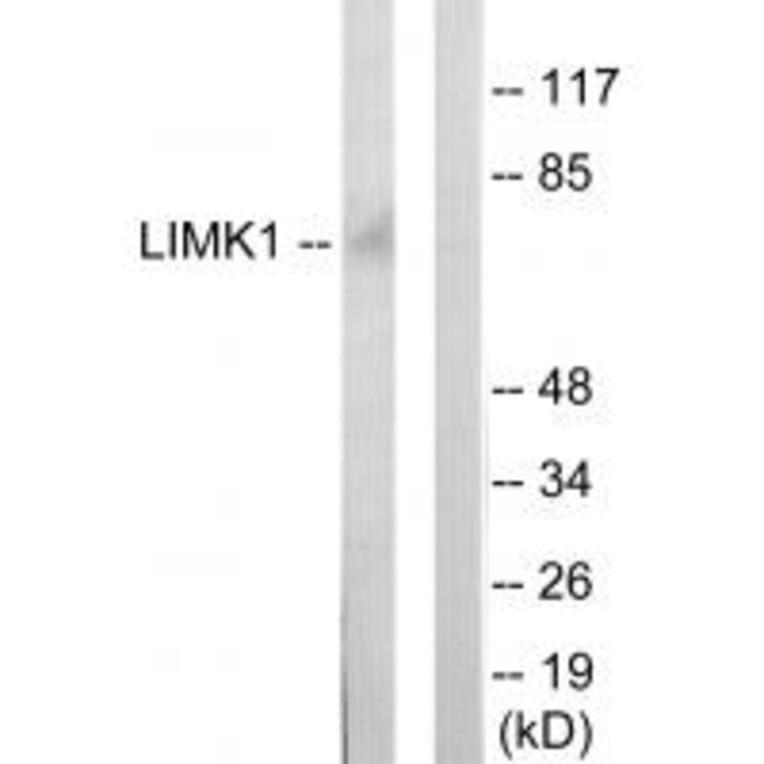 Western blot - LIMK1 Antibody from Signalway Antibody (33814) - Antibodies.com