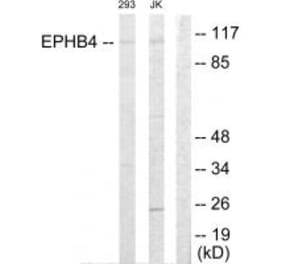 Western blot - EPHB4 Antibody from Signalway Antibody (33819) - Antibodies.com