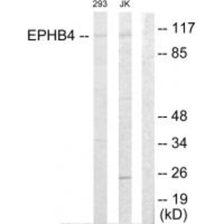 Western blot - EPHB4 Antibody from Signalway Antibody (33819) - Antibodies.com