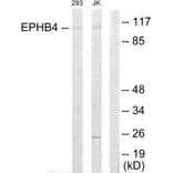 Western blot - EPHB4 Antibody from Signalway Antibody (33819) - Antibodies.com
