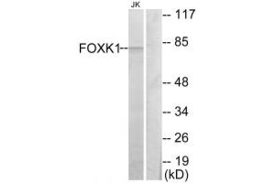 Western blot - FOXK1 Antibody from Signalway Antibody (33840) - Antibodies.com