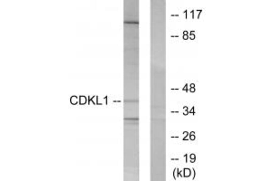 Western blot - CDKL1 Antibody from Signalway Antibody (33842) - Antibodies.com