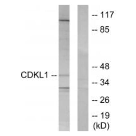 Western blot - CDKL1 Antibody from Signalway Antibody (33842) - Antibodies.com