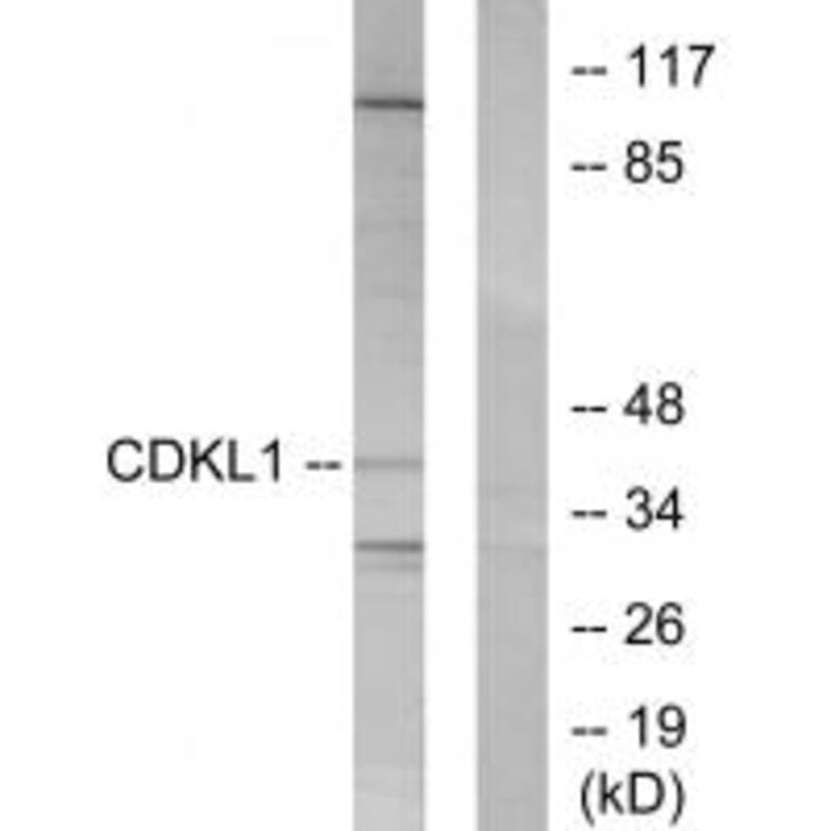 Western blot - CDKL1 Antibody from Signalway Antibody (33842) - Antibodies.com