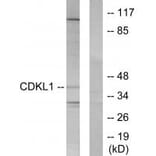 Western blot - CDKL1 Antibody from Signalway Antibody (33842) - Antibodies.com