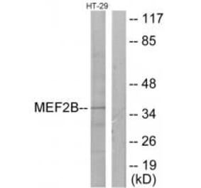 Western blot - MEF2B Antibody from Signalway Antibody (33845) - Antibodies.com