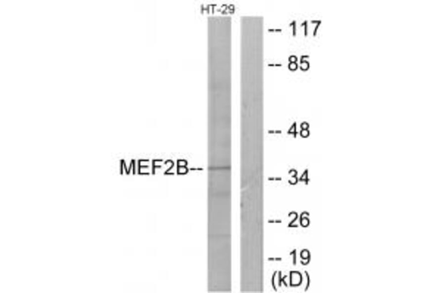 Western blot - MEF2B Antibody from Signalway Antibody (33845) - Antibodies.com