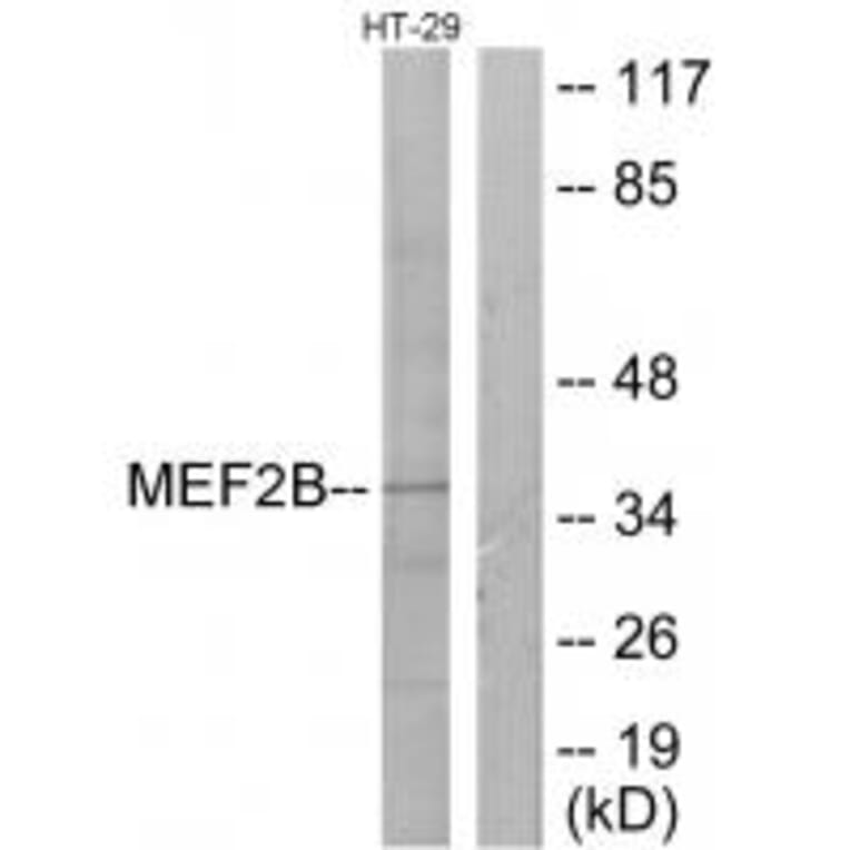 Western blot - MEF2B Antibody from Signalway Antibody (33845) - Antibodies.com