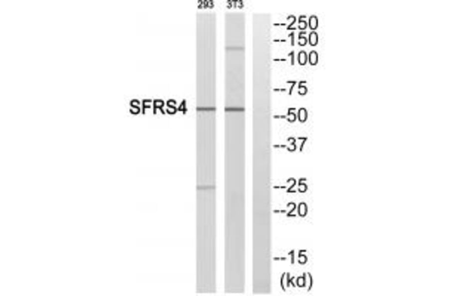 Western blot - SFRS4 Antibody from Signalway Antibody (33862) - Antibodies.com