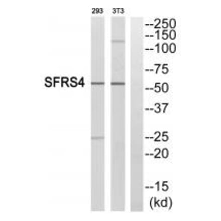 Western blot - SFRS4 Antibody from Signalway Antibody (33862) - Antibodies.com