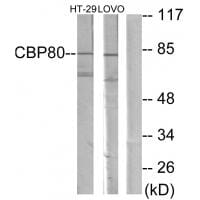 Western blot analysis of extracts from HT-29 cells and LOVO cells, using NCBP1 antibody #33864.