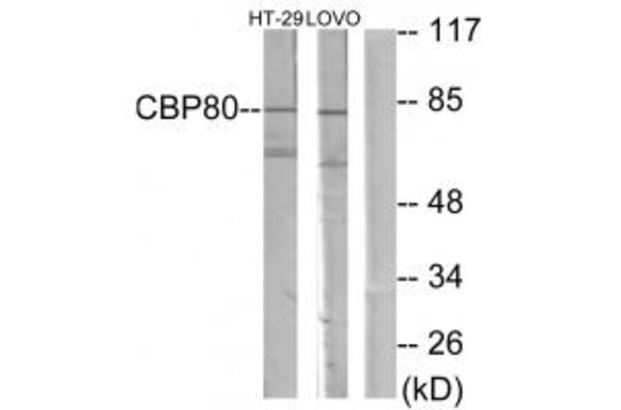 Western blot - NCBP1 Antibody from Signalway Antibody (33864) - Antibodies.com