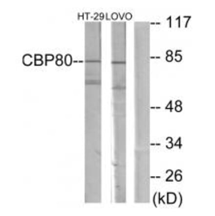 Western blot - NCBP1 Antibody from Signalway Antibody (33864) - Antibodies.com