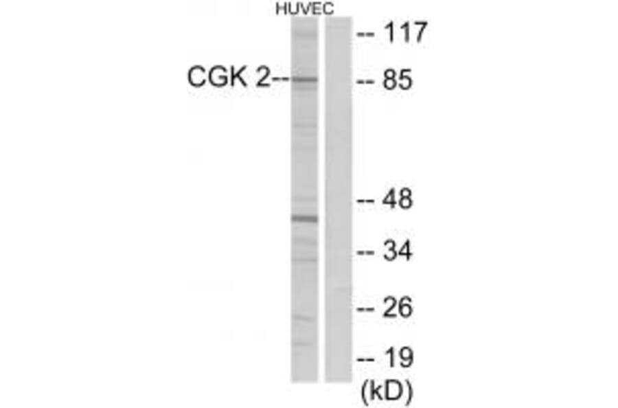 Western blot - CGK 2 Antibody from Signalway Antibody (33867) - Antibodies.com