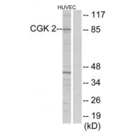 Western blot - CGK 2 Antibody from Signalway Antibody (33867) - Antibodies.com