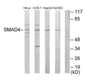Western blot - Smad4 Antibody from Signalway Antibody (33868) - Antibodies.com