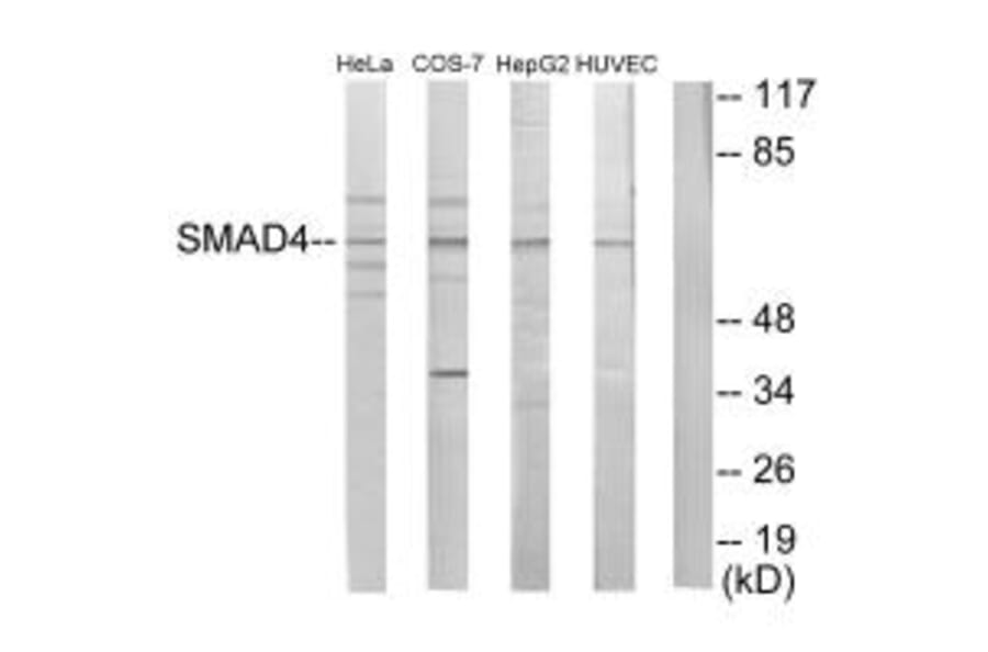 Western blot - Smad4 Antibody from Signalway Antibody (33868) - Antibodies.com