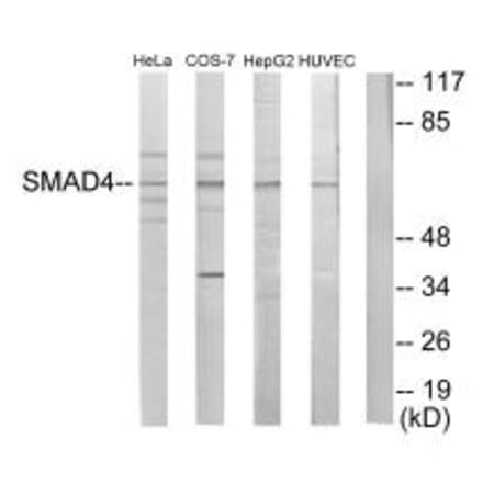 Western blot - Smad4 Antibody from Signalway Antibody (33868) - Antibodies.com