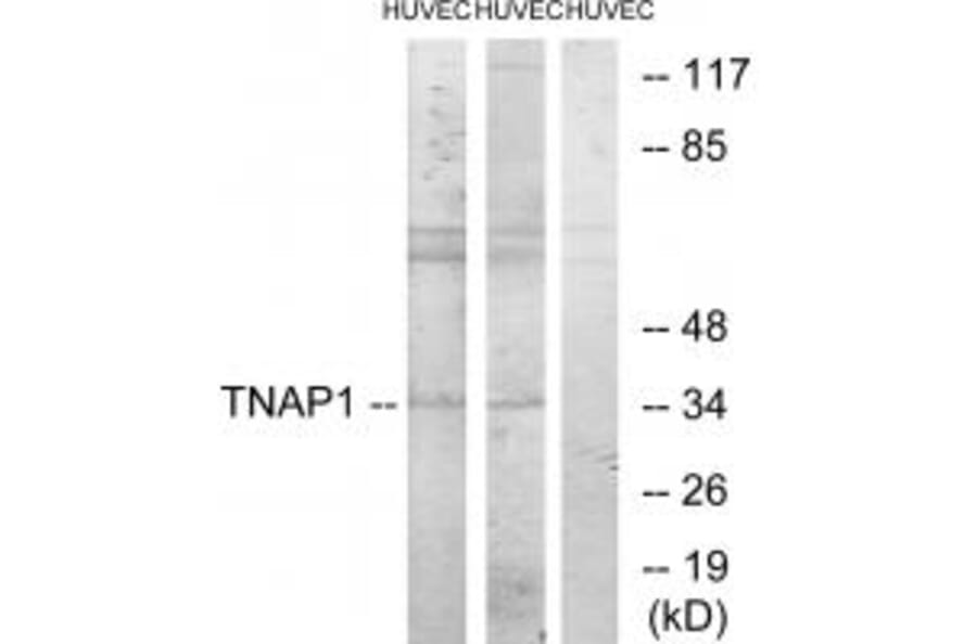 Western blot - TNAP1 Antibody from Signalway Antibody (33873) - Antibodies.com