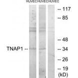 Western blot - TNAP1 Antibody from Signalway Antibody (33873) - Antibodies.com