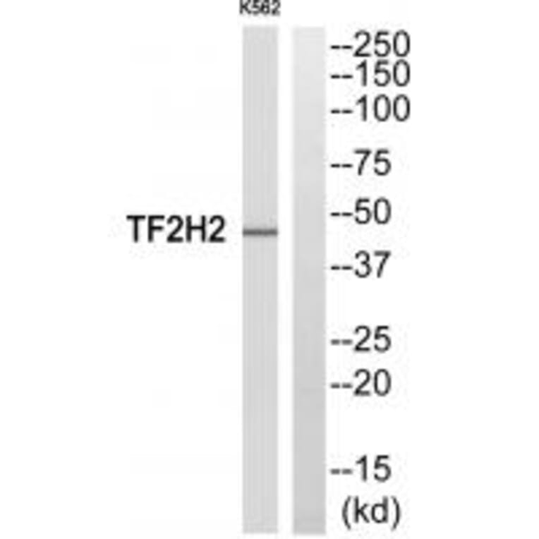 Western blot - TF2H2 Antibody from Signalway Antibody (33874) - Antibodies.com