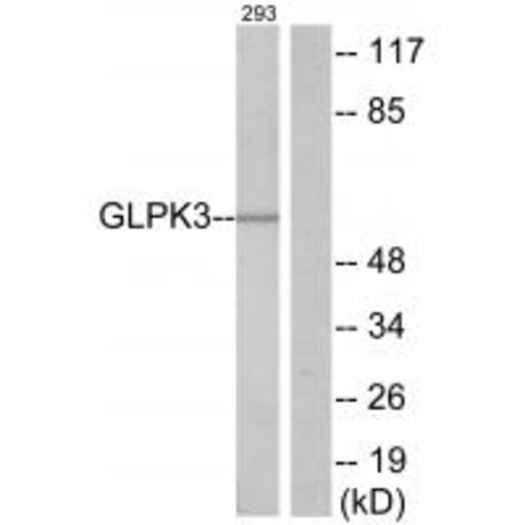 Western blot - GLPK3 Antibody from Signalway Antibody (33880) - Antibodies.com