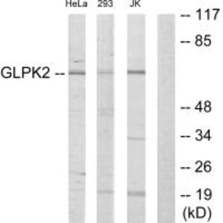 Western blot - GLPK2 Antibody from Signalway Antibody (33881) - Antibodies.com