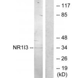 Western blot - NR1I3 Antibody from Signalway Antibody (33887) - Antibodies.com